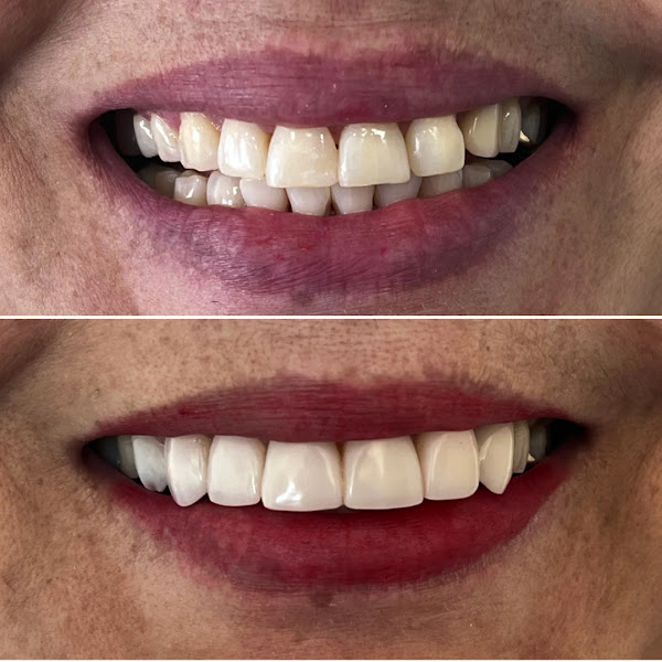 Foto 3 de Aguilar Odonto Implantes, Implante Dentário Montes Claros