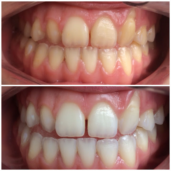 Foto 2 de AK Odontologia Integrada - Dra. Katia Teixeira de Lima Paula - Dr. Alvaro Teixeira de Lima Paula