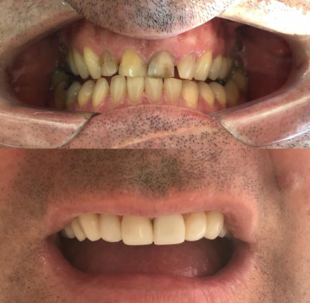 Foto 3 de AK Odontologia Integrada - Dra. Katia Teixeira de Lima Paula - Dr. Alvaro Teixeira de Lima Paula