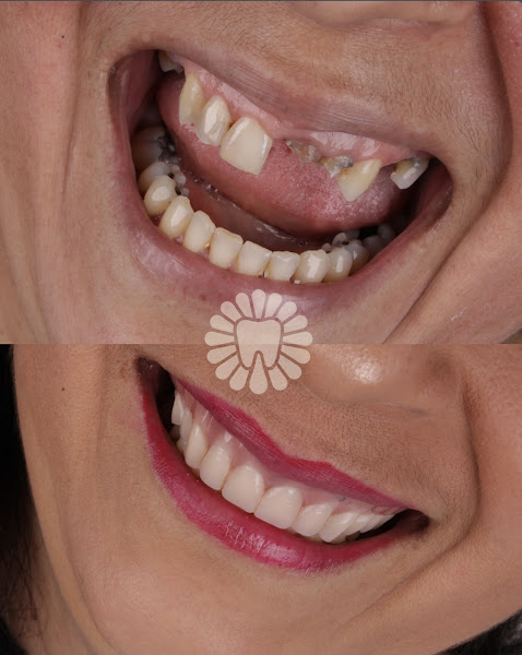 Foto 2 de AKO ODONTO