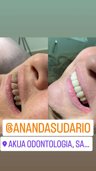 Foto 3 de AkuA Odontologia|Saúde|Bem-Estar