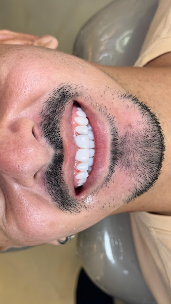 Foto 3 de AL CLINIC - ODONTOLOGIA ESTÉTICA E HARMONIZAÇÃO FACIAL