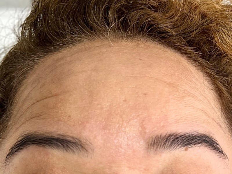 Foto 8 de AL CLINIC - ODONTOLOGIA ESTÉTICA E HARMONIZAÇÃO FACIAL