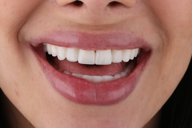 Foto 3 de Alamin Naves Odontologia