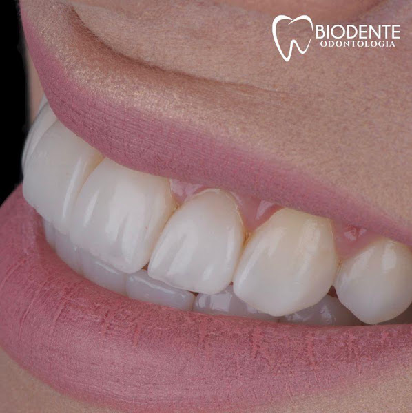 Foto 2 de ALB Biodente Odontologia - Clínica Odontológica/Teixeira de Freitas-BA
