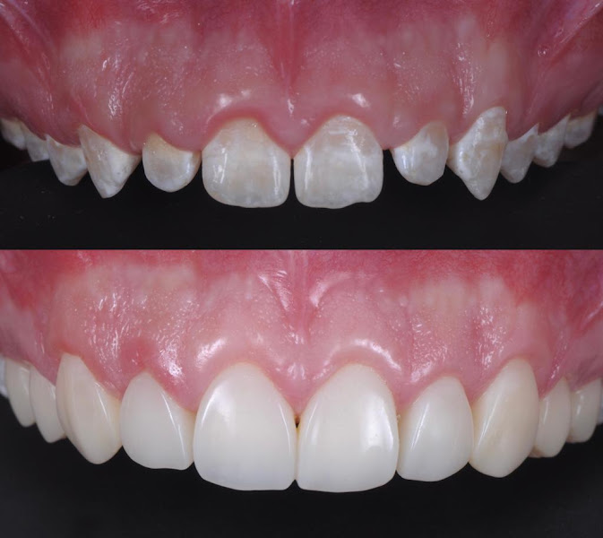 Foto 3 de ALB Biodente Odontologia - Clínica Odontológica/Teixeira de Freitas-BA