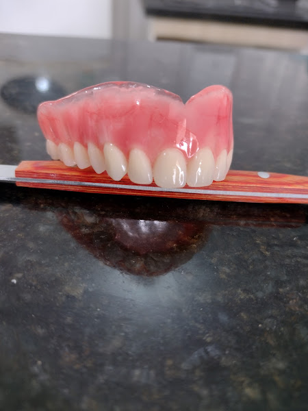Foto 2 de ALDS prótese odontológica