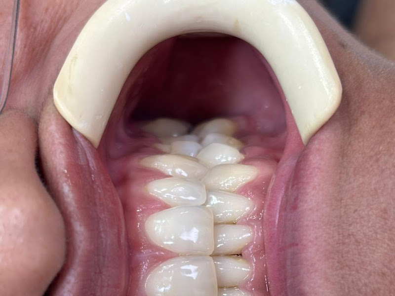 Foto 9 de Alem do dente|Dra. Carolina Borges| Dentista em Domicílio|Dentista Laserterapia| Dentista em Casa Recife| Sedaçao Recife