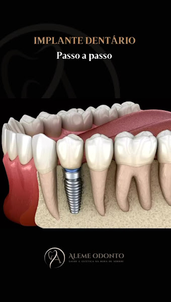 Foto 2 de Aleme Odontologia