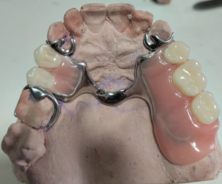 Foto de Alex Correia prótese dentária