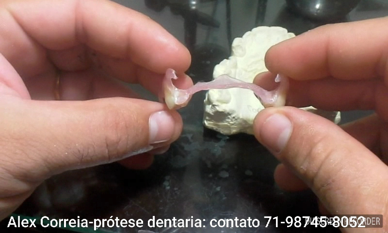 Foto 2 de Alex Correia prótese dentária