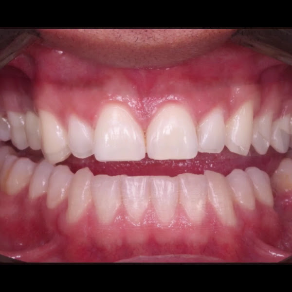 Foto 3 de Alexandre Bittar - Vincere Odontologia Personalizada