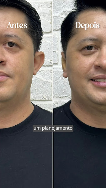 Foto 3 de Alexia Clinic - Estética Avançada