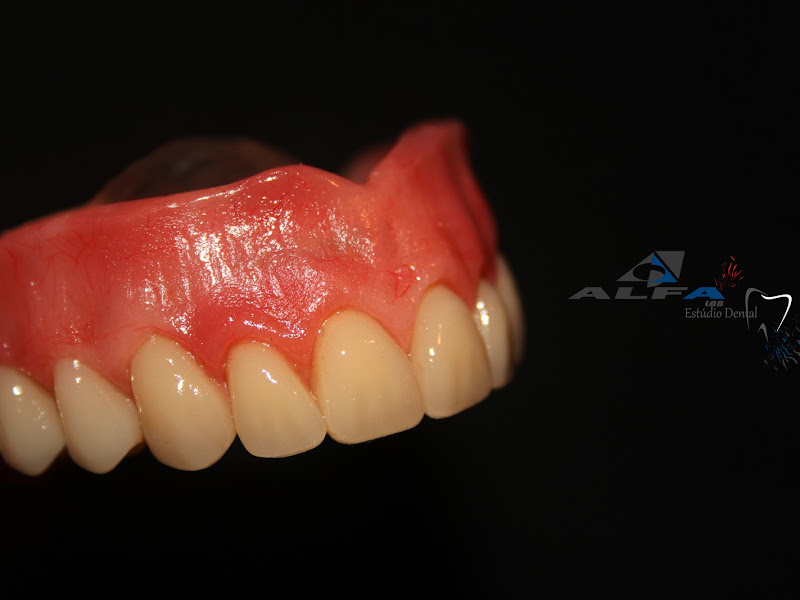 AlfaLab Estúdio Dental - Laboratório de Prótese Dentária - Protético e Orto-técnico