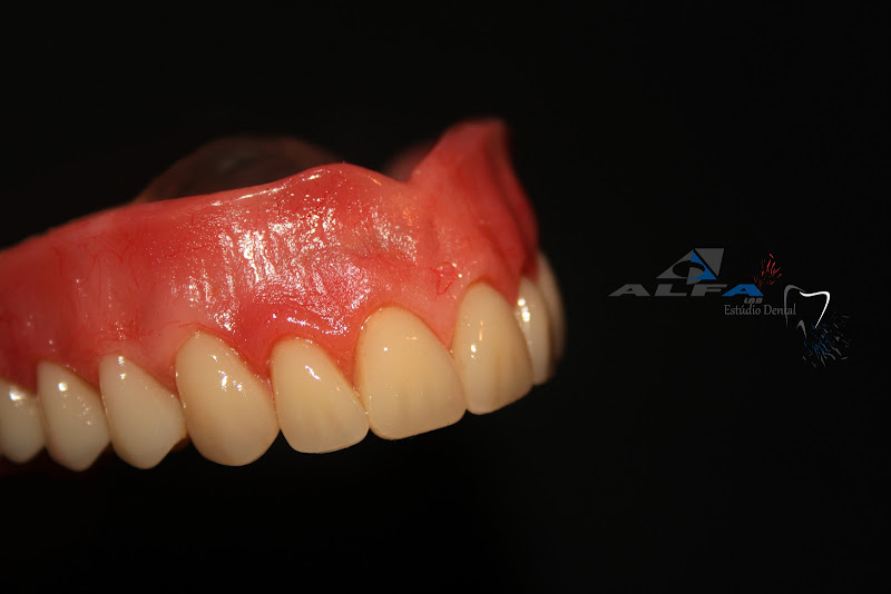 Foto 2 de AlfaLab Estúdio Dental - Laboratório de Prótese Dentária - Protético e Orto-técnico