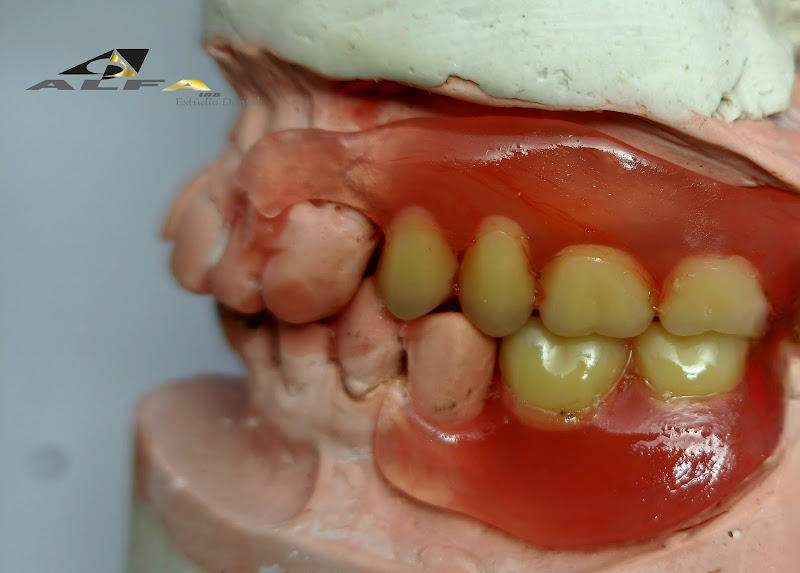 Foto 3 de AlfaLab Estúdio Dental - Laboratório de Prótese Dentária - Protético e Orto-técnico