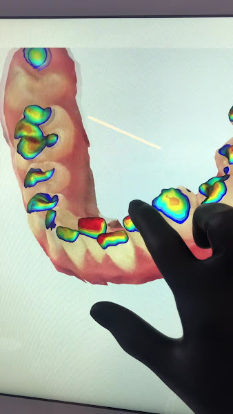 Foto 3 de Aligner Odontologia Dra Alessandra Haliski (implante ) e Dra Sidia Coser (ortodontia)