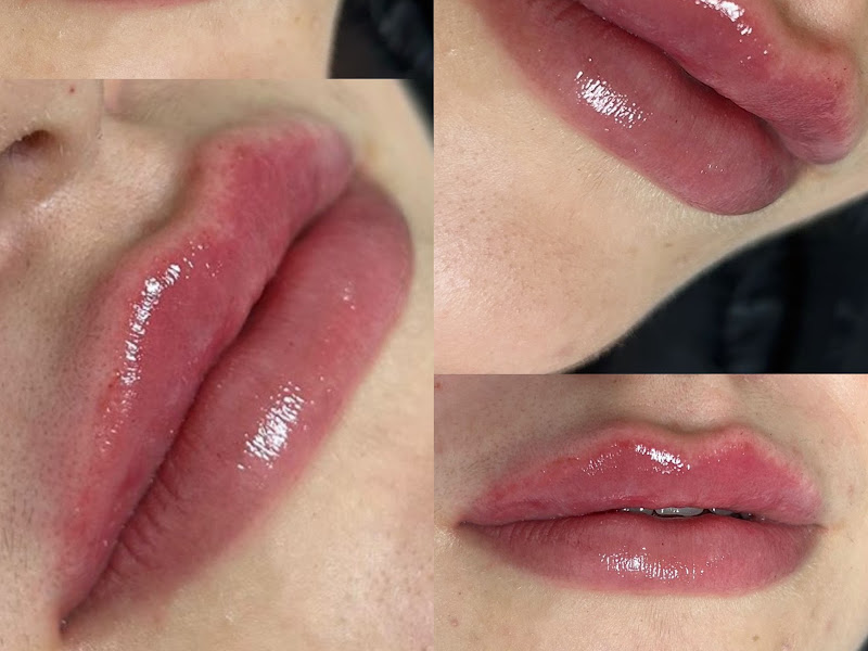 Foto 6 de Aline Demarchi - Lentes de contato dental | Passo Fundo