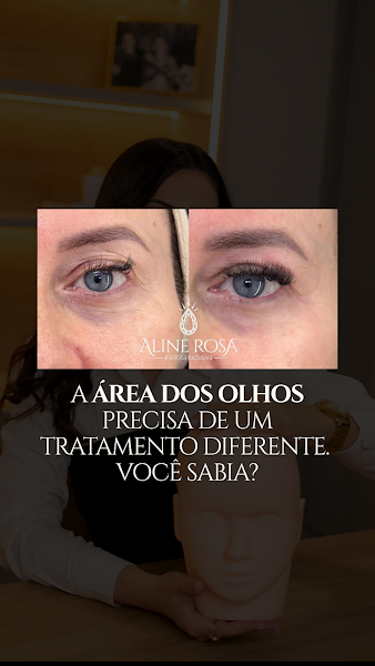 Foto 2 de Aline Rosa Estética Exclusiva - Harmonização Facial e Botox