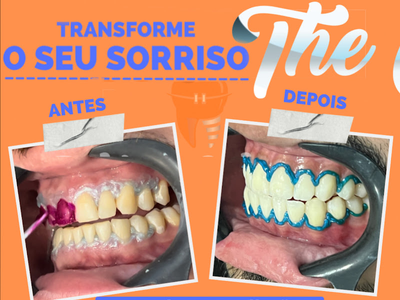 Foto 2 de Alirio Trindade Da Silva Benjamin