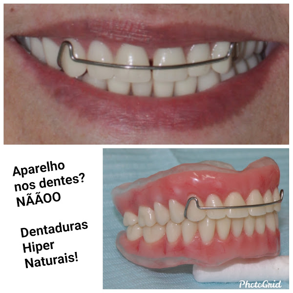 Foto 3 de ÁLIS - Odontologia Avançada