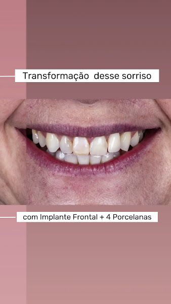Foto 4 de ÁLIS - Odontologia Avançada