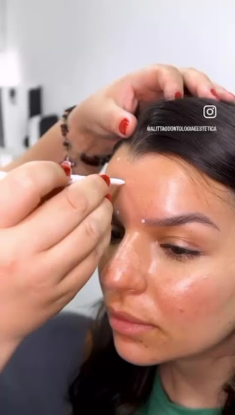 Foto 3 de Alittá Odontologia e Estética | Dentistas SBC | Implantes Dentários | Harmonização Facial | Alinhadores Invisíveis