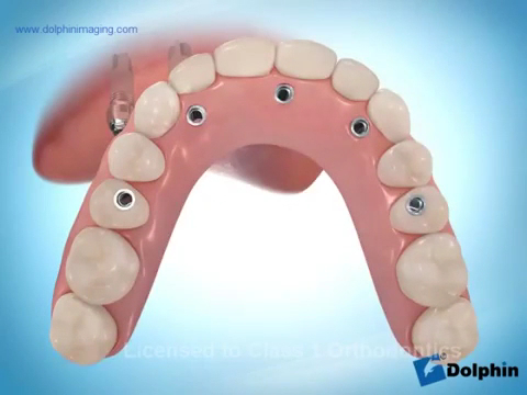 Foto 4 de Alittá Odontologia e Estética | Dentistas SBC | Implantes Dentários | Harmonização Facial | Alinhadores Invisíveis
