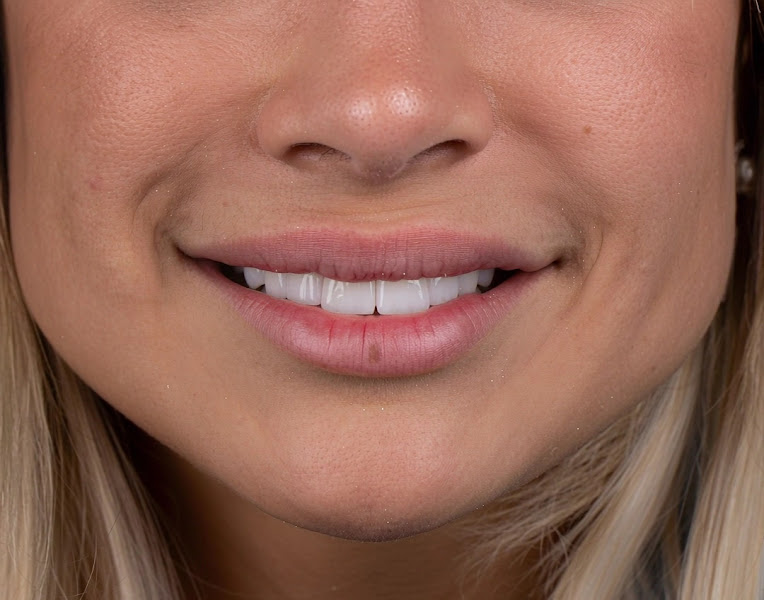 Foto 4 de Allegra Odontologia Tatuapé | Estética Dental