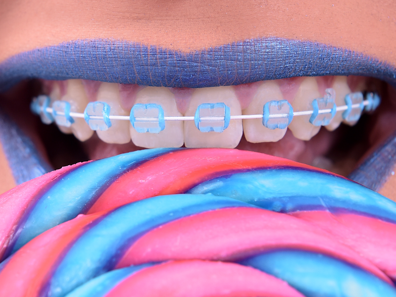 Foto 10 de Allegra Odontologia Tatuapé | Estética Dental