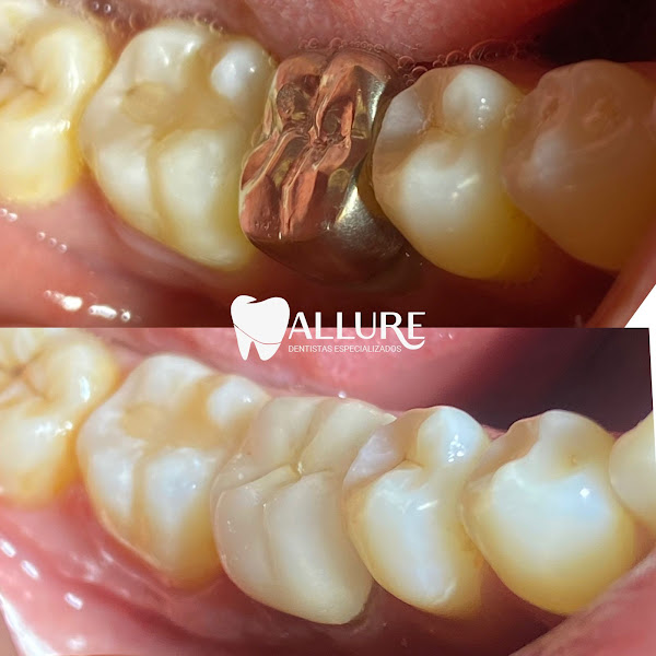Foto 2 de Allure Dentistas Especializados