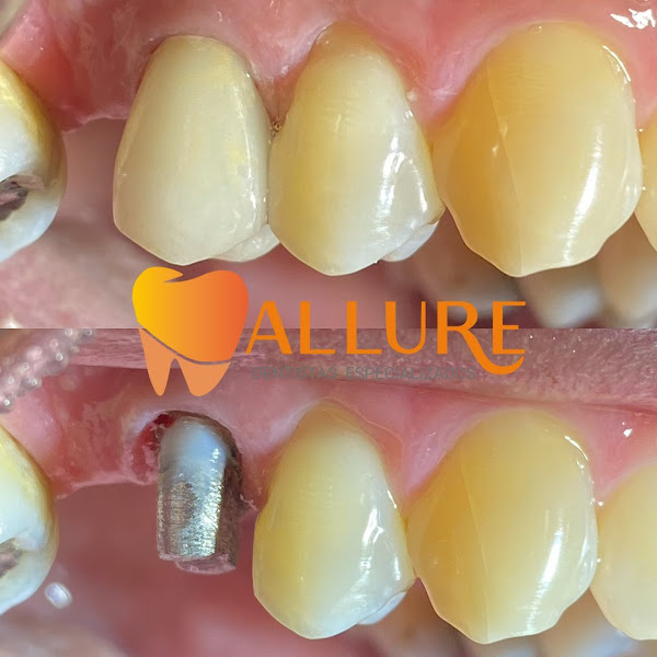 Foto 3 de Allure Dentistas Especializados