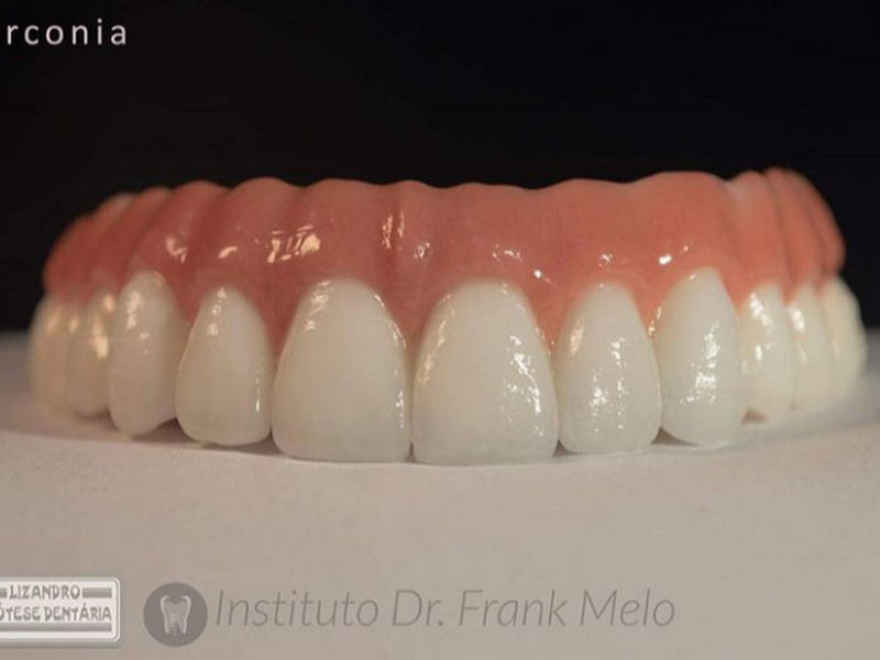 Foto de Allzircon Laboratório Prótese Dentária