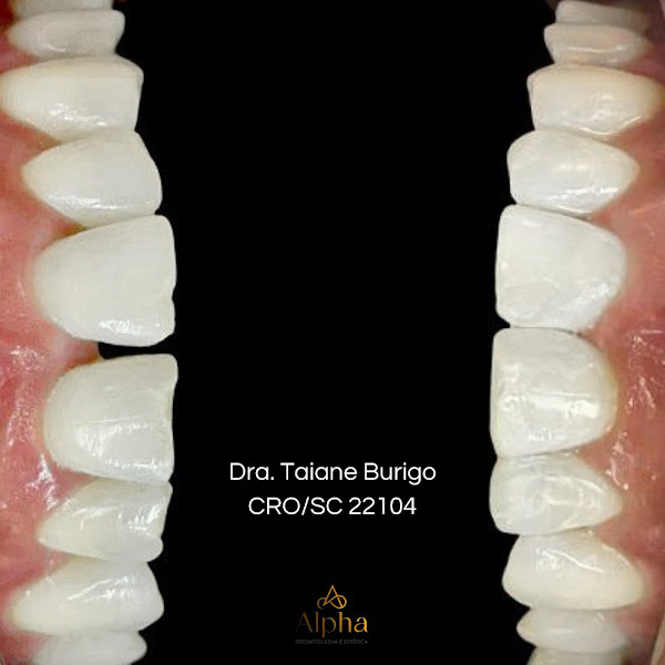 Foto 3 de Alpha Odontologia e Estética