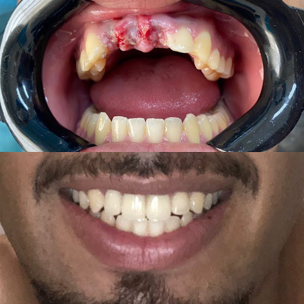 Foto 3 de Alpha Odontologia Invisalign