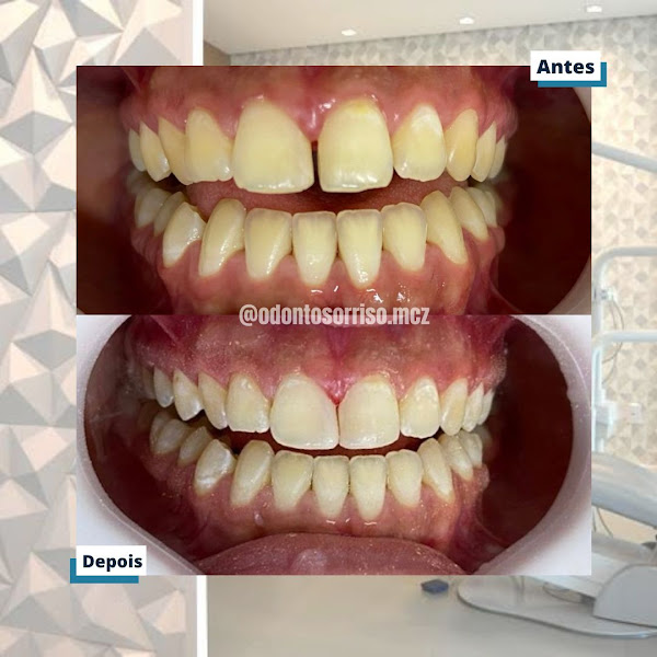 Foto 3 de Alves Barros Odontologia Integrada