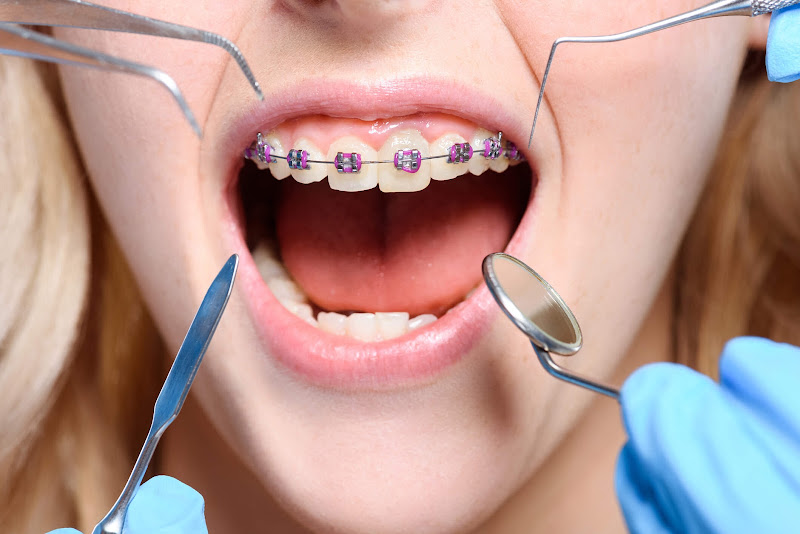 Foto 2 de Alves Odontologia - Doutor Laureano