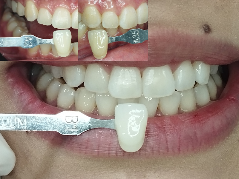 Foto 10 de Ama Odonto Multiclínica