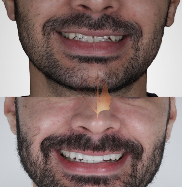 Foto 2 de Aman Odontologia Estética