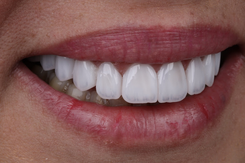 Foto 2 de Amâncio Odontologia | Dentista Dr. Phelipe Amâncio