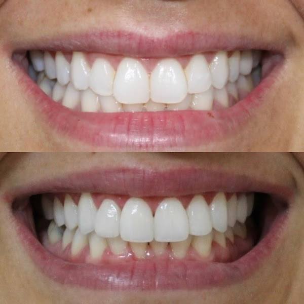 Foto 3 de Amaral Odontologia e Estética