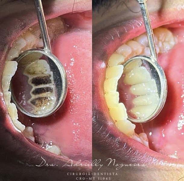 Foto 3 de Amarílis Odontologia Especializada