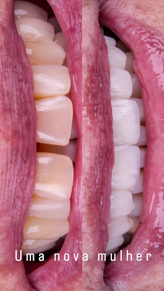 Foto 4 de AMD Odontologia - Unidade Tatuapé