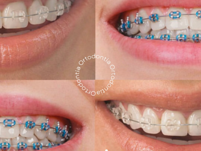 Foto 3 de AMIS Odontologia