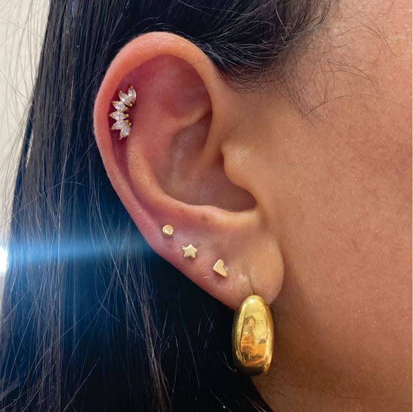 Foto 2 de Amoras Estética Auricular e Avançada