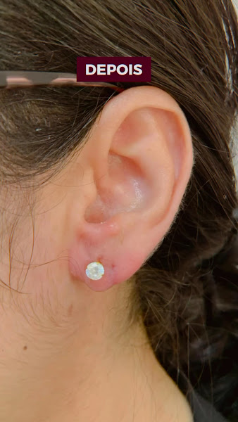 Foto 3 de Amoras Estética Auricular e Avançada