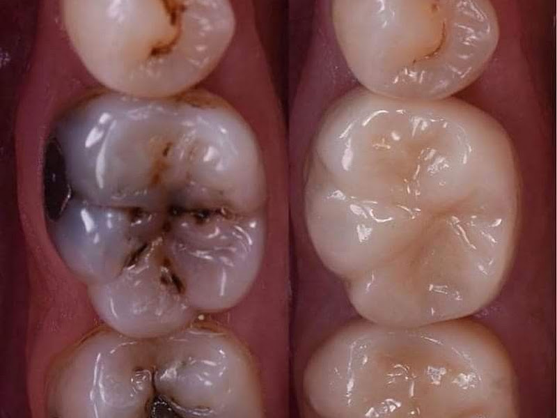 Foto 7 de Ampla Odontologia - Recife