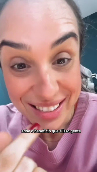 Foto 6 de AMS Odontologia — Clareamento Dental com LED Violeta | Facetas de Porcelana em Campinas