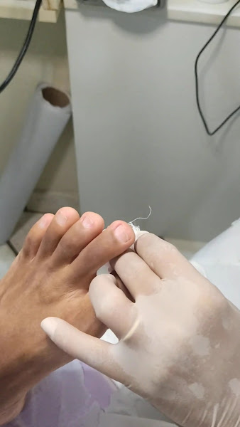 Foto 3 de Ana Galdênia Podologia e Estética