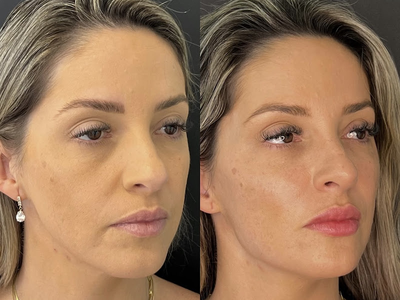 Foto 3 de Ana Júlia de Carvalho - Cirurgiã-dentista